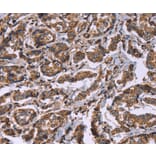 Immunohistochemistry - HSPE1 Antibody from Signalway Antibody (37636) - Antibodies.com