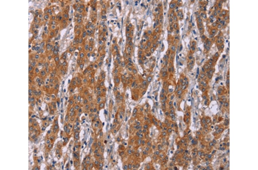 Immunohistochemistry - ICAM3 Antibody from Signalway Antibody (37638) - Antibodies.com