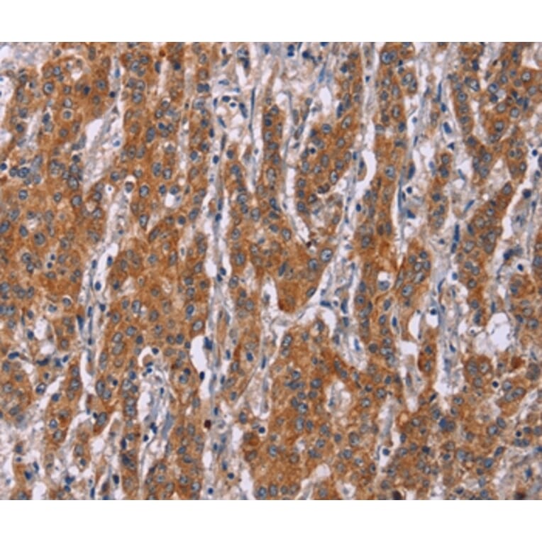 Immunohistochemistry - ICAM3 Antibody from Signalway Antibody (37638) - Antibodies.com