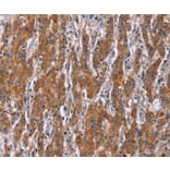 Immunohistochemistry - ICAM3 Antibody from Signalway Antibody (37638) - Antibodies.com