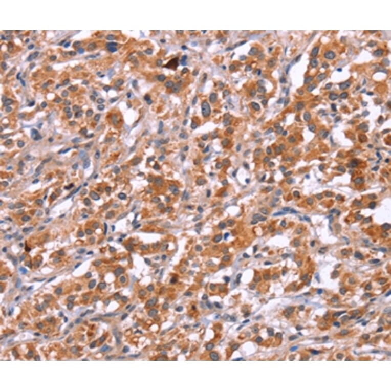 Immunohistochemistry - ICAM5 Antibody from Signalway Antibody (37639) - Antibodies.com