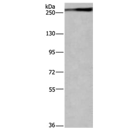 IGF2R Antibody from Signalway Antibody (37644) - Antibodies.com