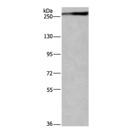 IGF2R Antibody from Signalway Antibody (37644) - Antibodies.com