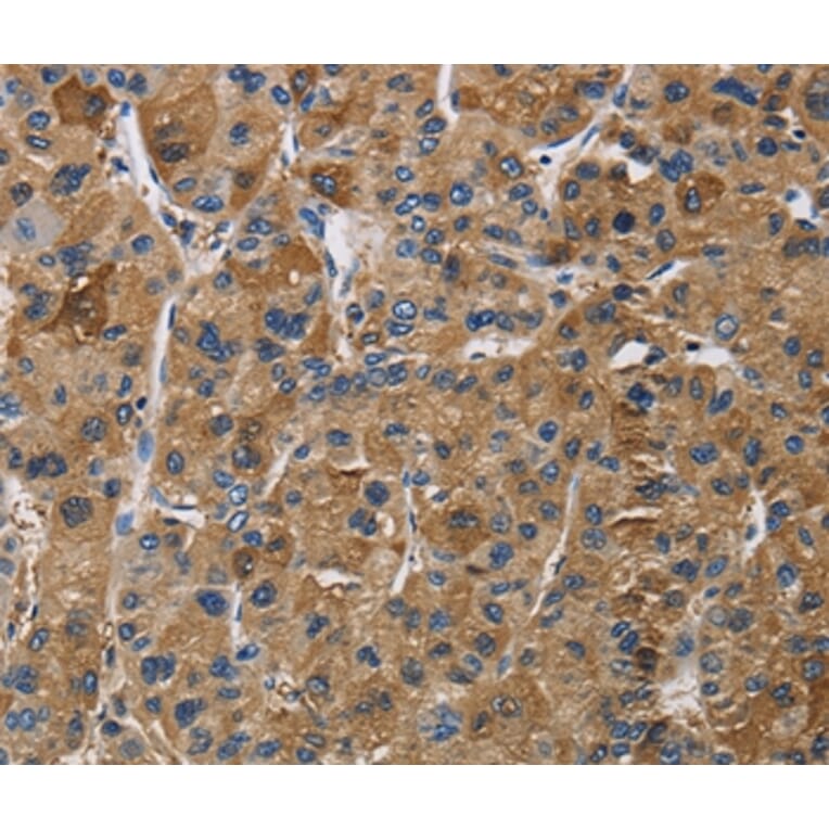 Immunohistochemistry - IGF2R Antibody from Signalway Antibody (37644) - Antibodies.com