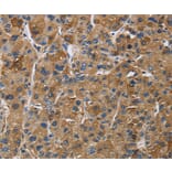 Immunohistochemistry - IGF2R Antibody from Signalway Antibody (37644) - Antibodies.com