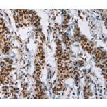 Immunohistochemistry - IL17C Antibody from Signalway Antibody (37646) - Antibodies.com