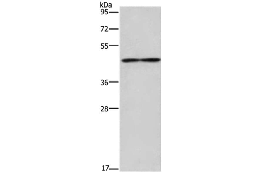 IL5RA Antibody from Signalway Antibody (37652) - Antibodies.com