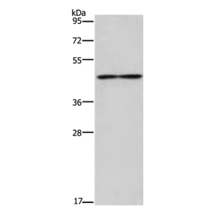 IL5RA Antibody from Signalway Antibody (37652) - Antibodies.com