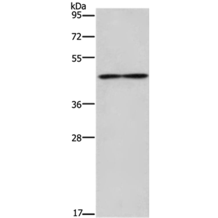 IL5RA Antibody from Signalway Antibody (37652) - Antibodies.com