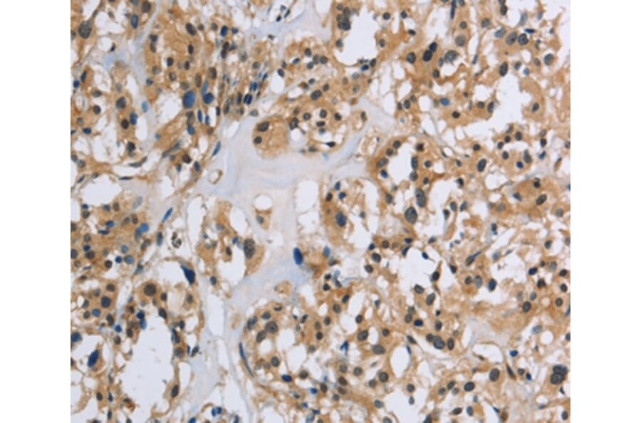 Immunohistochemistry - IL5RA Antibody from Signalway Antibody (37652) - Antibodies.com