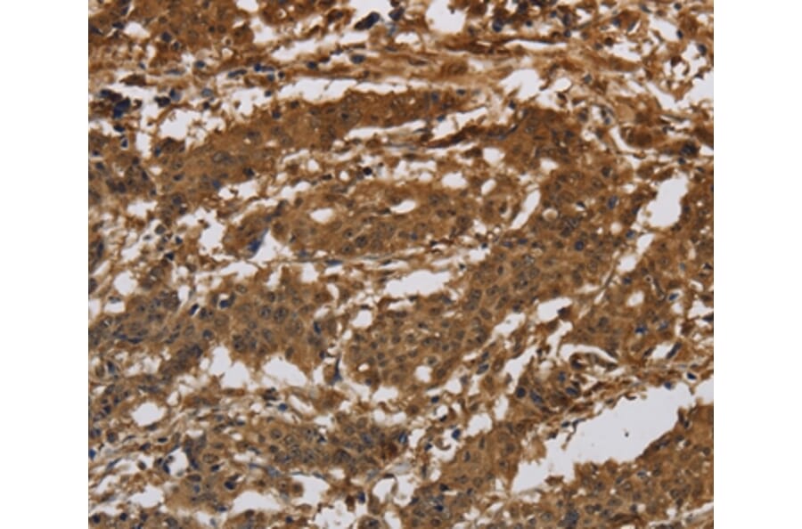Immunohistochemistry - ITGB7 Antibody from Signalway Antibody (37662) - Antibodies.com