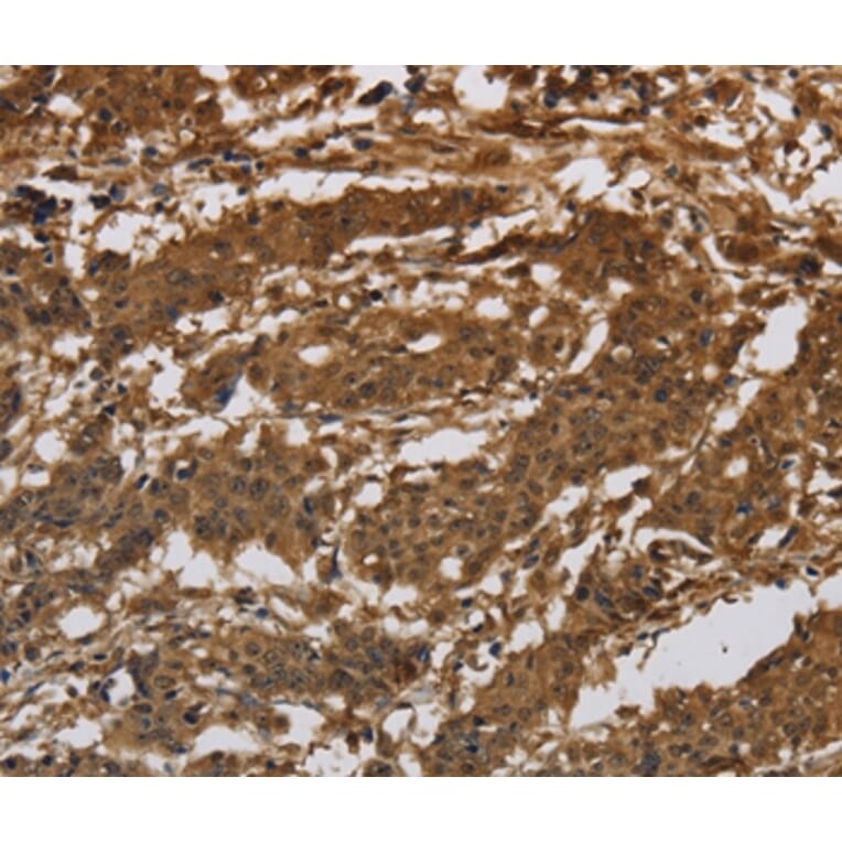 Immunohistochemistry - ITGB7 Antibody from Signalway Antibody (37662) - Antibodies.com