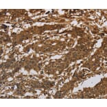 Immunohistochemistry - ITGB7 Antibody from Signalway Antibody (37662) - Antibodies.com