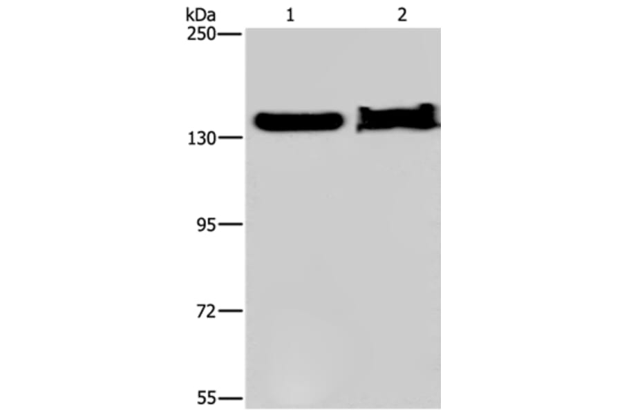 KDM4A Antibody from Signalway Antibody (37671) - Antibodies.com