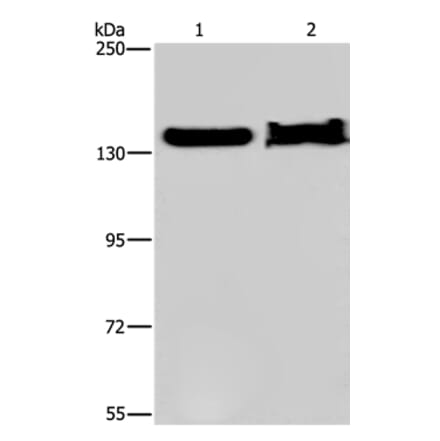 KDM4A Antibody from Signalway Antibody (37671) - Antibodies.com