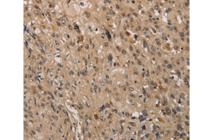 Immunohistochemistry - KDM4A Antibody from Signalway Antibody (37671) - Antibodies.com