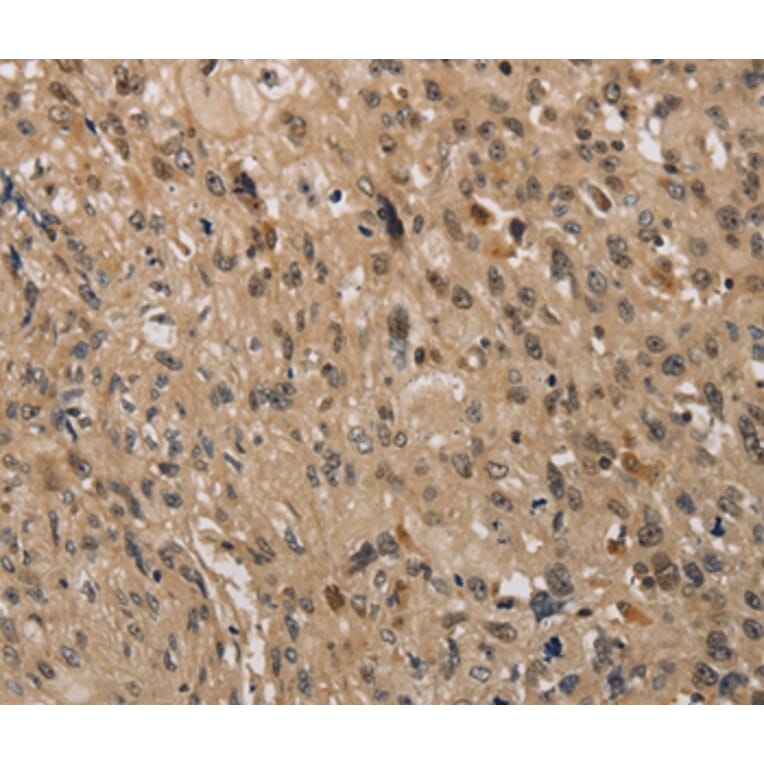 Immunohistochemistry - KDM4A Antibody from Signalway Antibody (37671) - Antibodies.com