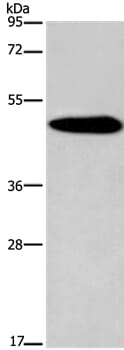 Gel: 8% SDS-PAGE Lysates (from left to right): Mouse brain tissue Amount of lysate: 40ug per lane Primary antibody: 1/650 dilution Secondary antibody dilution: 1/8000 Exposure time: 3 minutes