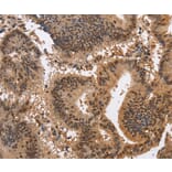 Immunohistochemistry - KCNG2 Antibody from Signalway Antibody (37675) - Antibodies.com