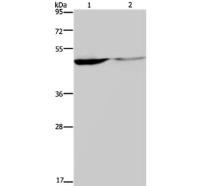 KCNK9 Antibody from Signalway Antibody (37678) - Antibodies.com