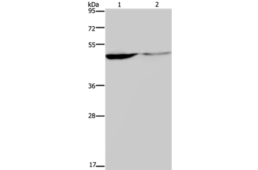 KCNK9 Antibody from Signalway Antibody (37678) - Antibodies.com