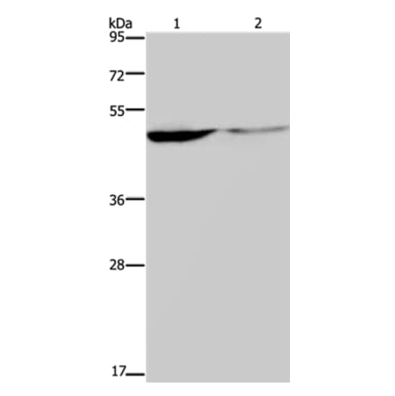 KCNK9 Antibody from Signalway Antibody (37678) - Antibodies.com