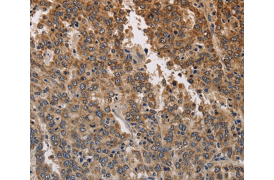 Immunohistochemistry - KCNK9 Antibody from Signalway Antibody (37678) - Antibodies.com