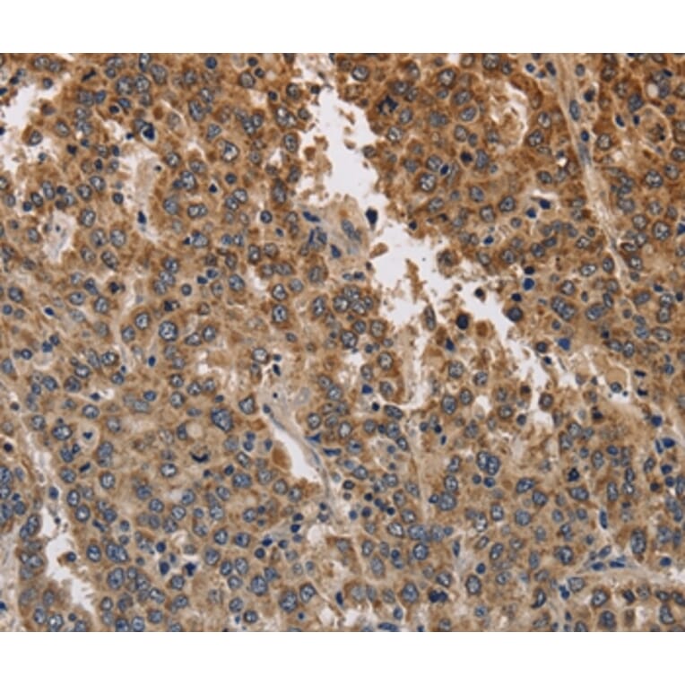 Immunohistochemistry - KCNK9 Antibody from Signalway Antibody (37678) - Antibodies.com