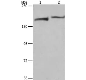 KDM5B Antibody from Signalway Antibody (37681) - Antibodies.com