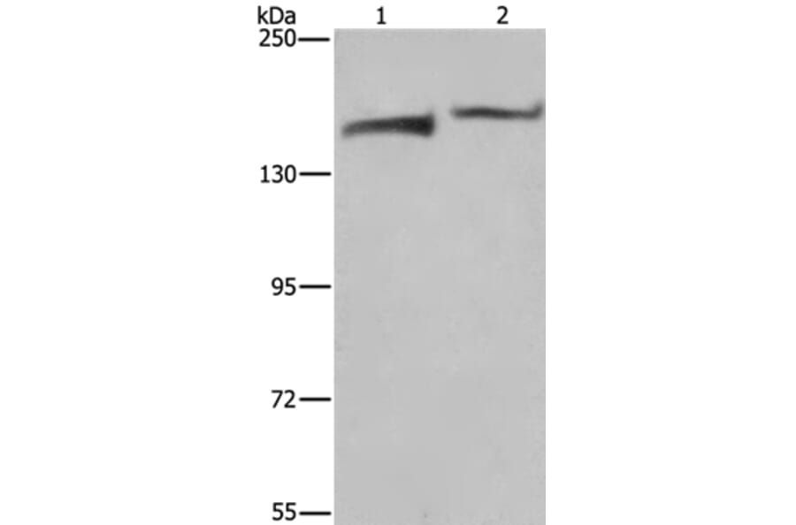 KDM5B Antibody from Signalway Antibody (37681) - Antibodies.com