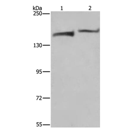 KDM5B Antibody from Signalway Antibody (37681) - Antibodies.com