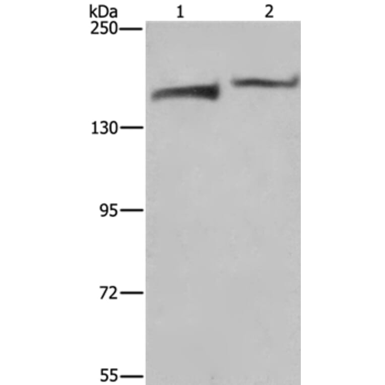KDM5B Antibody from Signalway Antibody (37681) - Antibodies.com