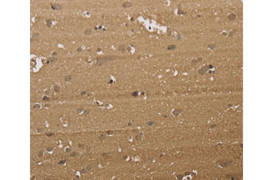 Immunohistochemistry - KDM5B Antibody from Signalway Antibody (37681) - Antibodies.com