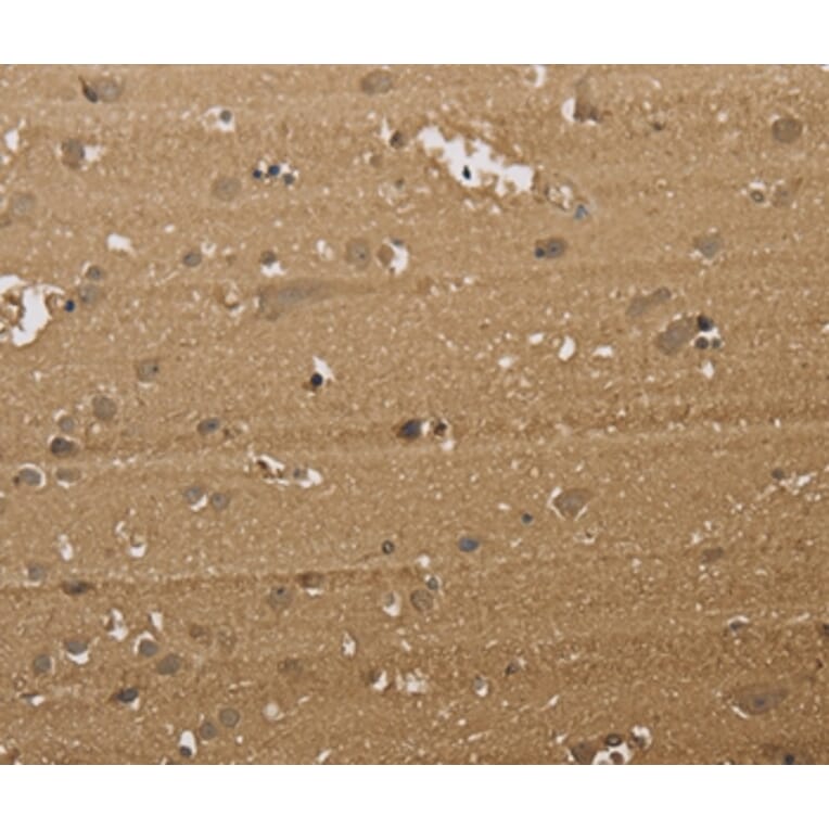 Immunohistochemistry - KDM5B Antibody from Signalway Antibody (37681) - Antibodies.com
