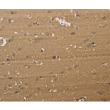 Immunohistochemistry - KDM5B Antibody from Signalway Antibody (37681) - Antibodies.com