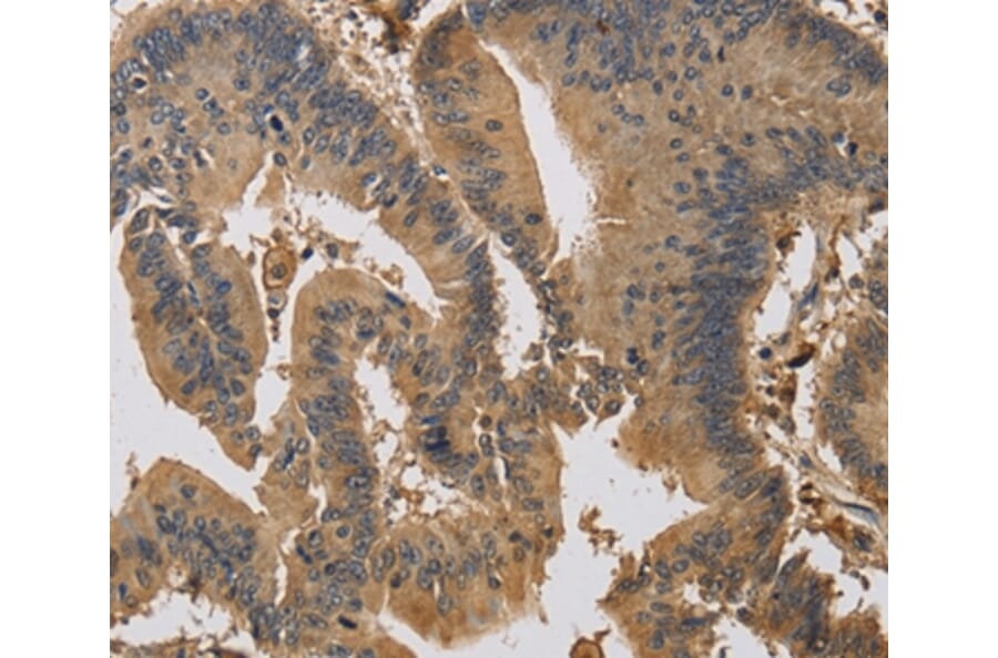 Immunohistochemistry - KIF22 Antibody from Signalway Antibody (37684) - Antibodies.com