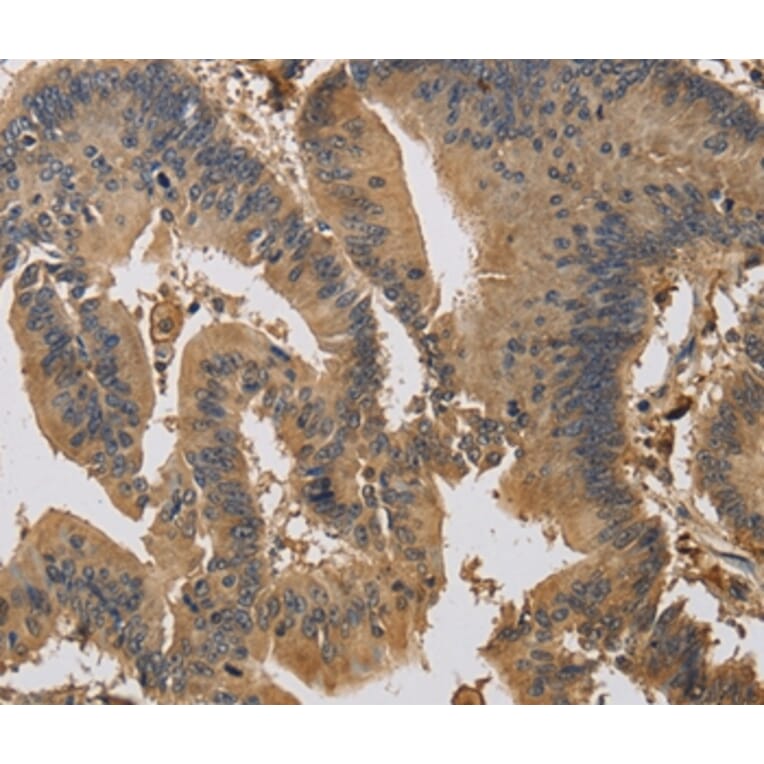 Immunohistochemistry - KIF22 Antibody from Signalway Antibody (37684) - Antibodies.com