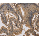 Immunohistochemistry - KIF22 Antibody from Signalway Antibody (37684) - Antibodies.com