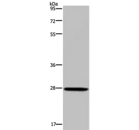 KLK14 Antibody from Signalway Antibody (37688) - Antibodies.com