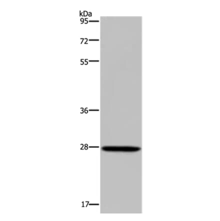 KLK14 Antibody from Signalway Antibody (37688) - Antibodies.com