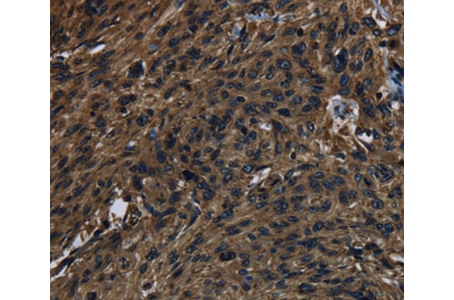 Immunohistochemistry - KLK14 Antibody from Signalway Antibody (37688) - Antibodies.com