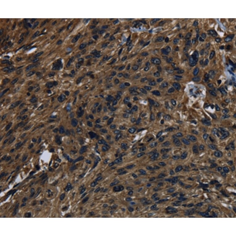 Immunohistochemistry - KLK14 Antibody from Signalway Antibody (37688) - Antibodies.com