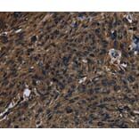 Immunohistochemistry - KLK14 Antibody from Signalway Antibody (37688) - Antibodies.com