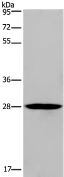 Gel: 10% SDS-PAGE Lysates (from left to right): Human bladder carcinoma tissue Amount of lysate: 40ug per lane Primary antibody: 1/300 dilution Secondary antibody dilution: 1/8000 Exposure time: 2 minutes