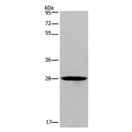 KLRF1 Antibody from Signalway Antibody (37690) - Antibodies.com