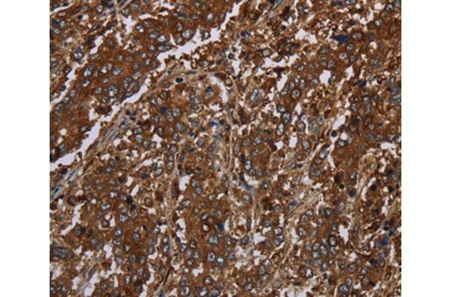 Immunohistochemistry - KLRF1 Antibody from Signalway Antibody (37690) - Antibodies.com