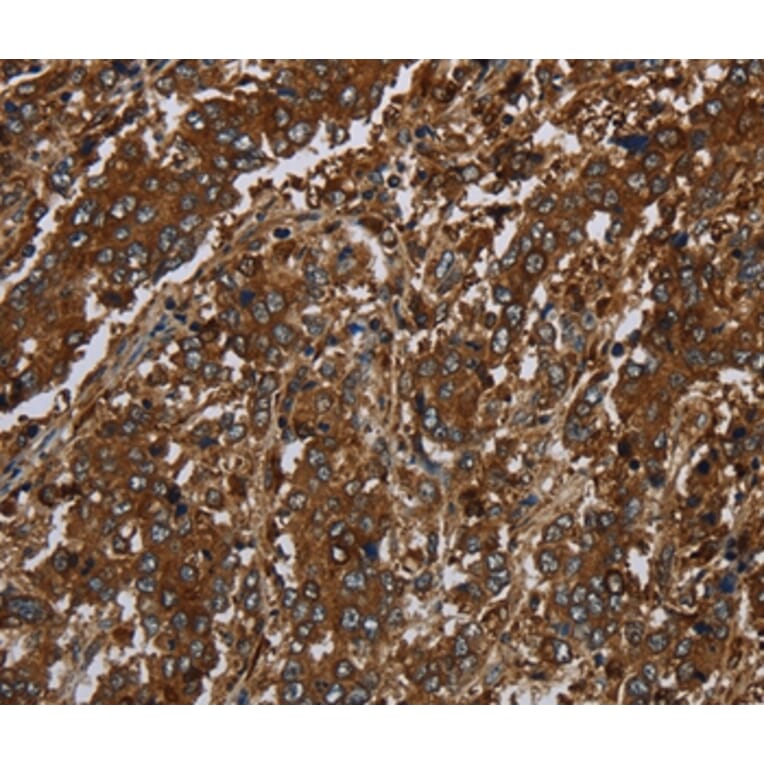 Immunohistochemistry - KLRF1 Antibody from Signalway Antibody (37690) - Antibodies.com