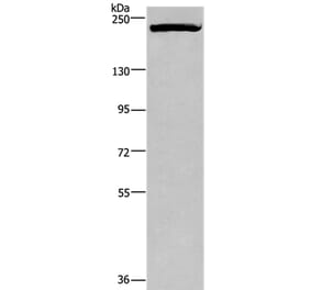 PRDM2 Antibody from Signalway Antibody (37691) - Antibodies.com