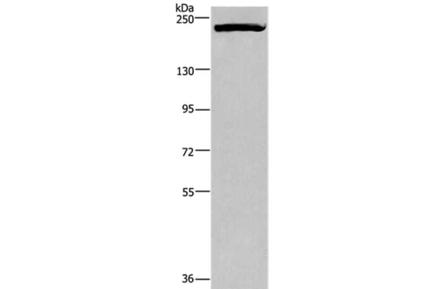 PRDM2 Antibody from Signalway Antibody (37691) - Antibodies.com