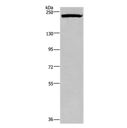 PRDM2 Antibody from Signalway Antibody (37691) - Antibodies.com